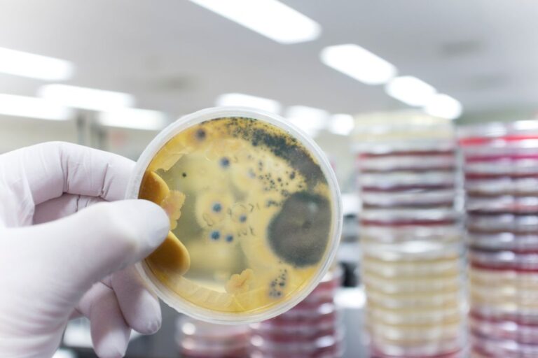 Silent threat: French scientist explains how fungi can hide in your body and resist treatment