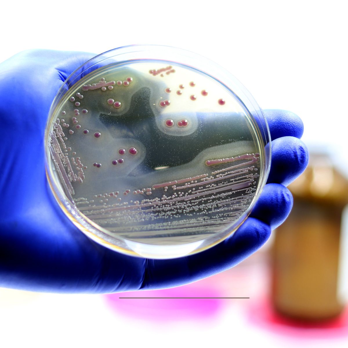 MICRONATIB Project PhD Position focused on screening natural compounds against the intracellular phase of Staphylococcus aureus.Deadline: March 10, 2026