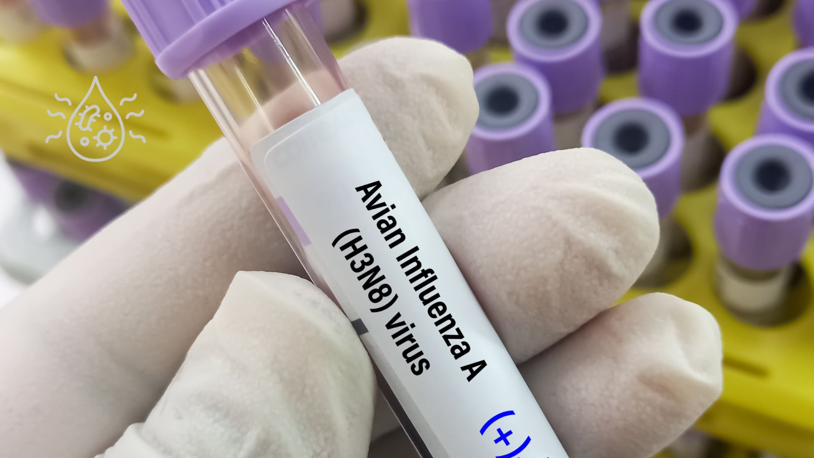 Estudo do IPSP antecipa surtos de influenza em São Paulo com duas semanas de antecedência a partir de amostras de água residuais